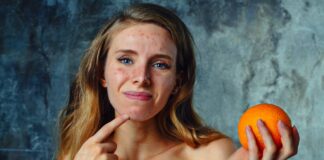 Vodič kroz alergije i reakcije: Izbacite hranu koja vas truje