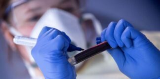 Test na koronu može biti negativan i kada ste zaraženi i širite virus