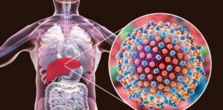Hepatitis – virusni, bakterijski, autoimuni, alkoholni