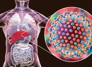 Hepatitis – virusni, bakterijski, autoimuni, alkoholni