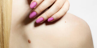 Ovih 11 znakova upućuju na rak kože