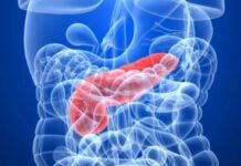 Nova pretraga za ranije otkrivanje raka gušterače