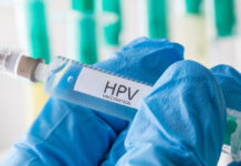 HPV (humani papiloma virus) – simptomi, faze infekcije. HPV i rak grlića maternice