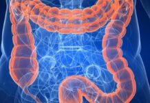 Kolonoskopija drastično smanjuje rizik od naprednog oblika raka