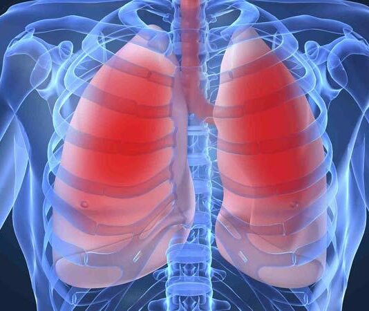 Upala pluća (Pneumonija): Simptomi, prevencija i liječenje