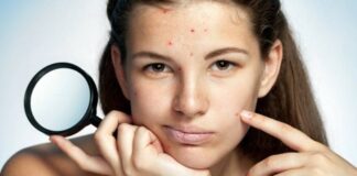 Jedna će vas namirnica riješiti akni i učiniti kožu predivnom, a na nju niste niti pomislili