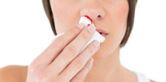 Što napraviti kada vam curi krv iz nosa, a što nikako ne smijete? Pratite ova tri koraka