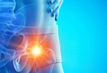 10 načina kako se riješiti bolova u kukovima i što ako je ta bol samo dio većeg problema