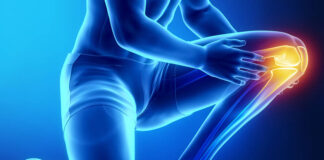 Bakerova cista – koliko je stvarno opasno ovo stanje i kako se liječi?